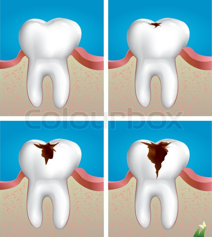 Decaying clipart 20 free Cliparts Download images on