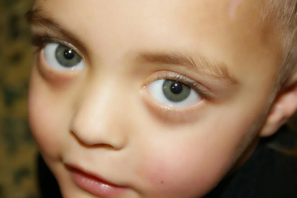 Siblings speak out and say NO to the word 'Retard' - Parent to Parent