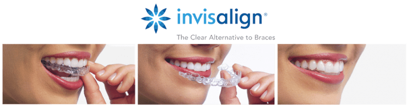 Am I Too Old to Get Invisalign®? Dentists Grand Rapids MI
