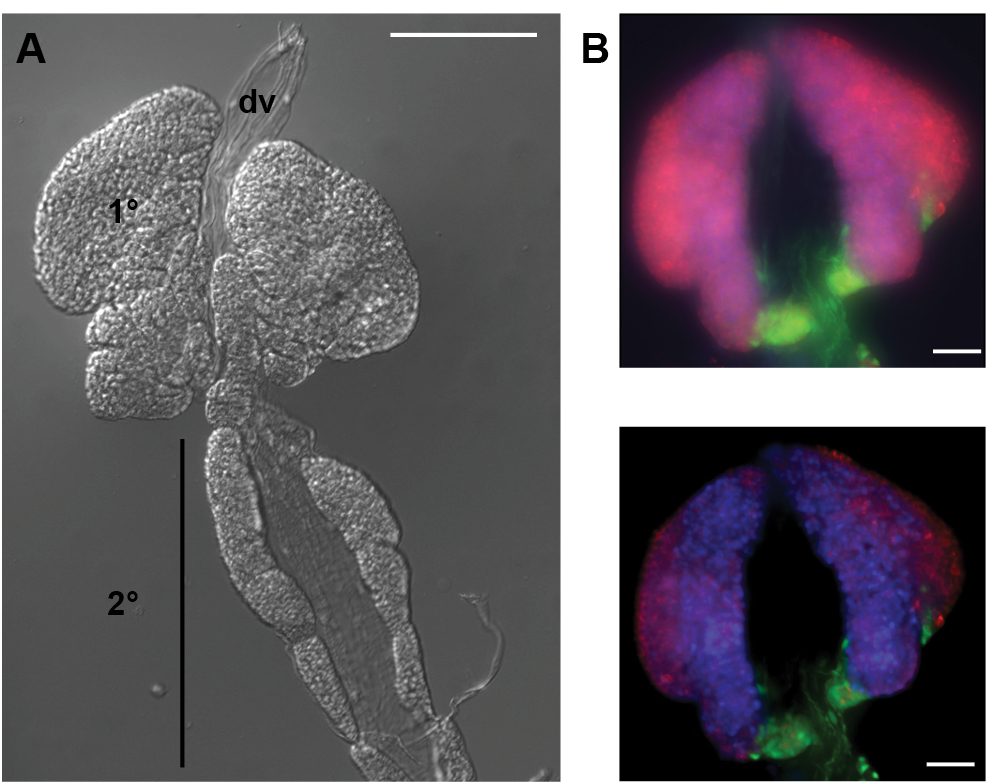 Methods to Examine the Lymph Gland and Hemocytes in Drosophila Larvae