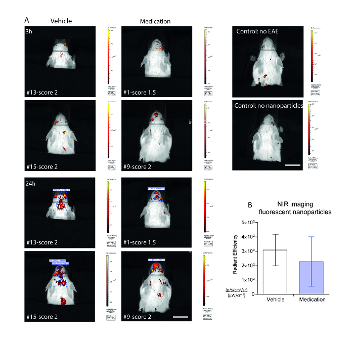 Bioluminescence and Nearinfrared Imaging of Optic Neuritis and Brain