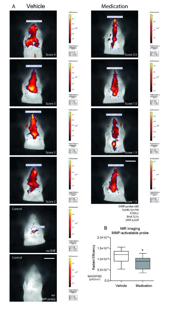 Bioluminescence and Nearinfrared Imaging of Optic Neuritis and Brain