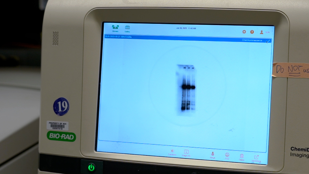 Western Blotting of Digested DNA Samples Containing DNAProtein
