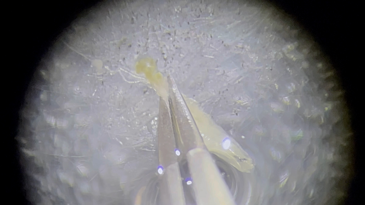Fat Body Collection from Drosophila melanogaster Third Instar Larvae