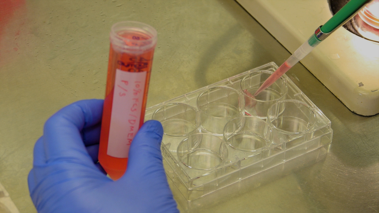 Chicken Skin Explant Culture for Organogenesis Study