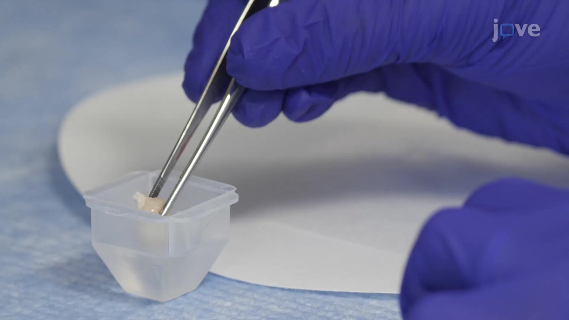 Cryopreservation of Murine Brain by Snap Freezing A Technique to