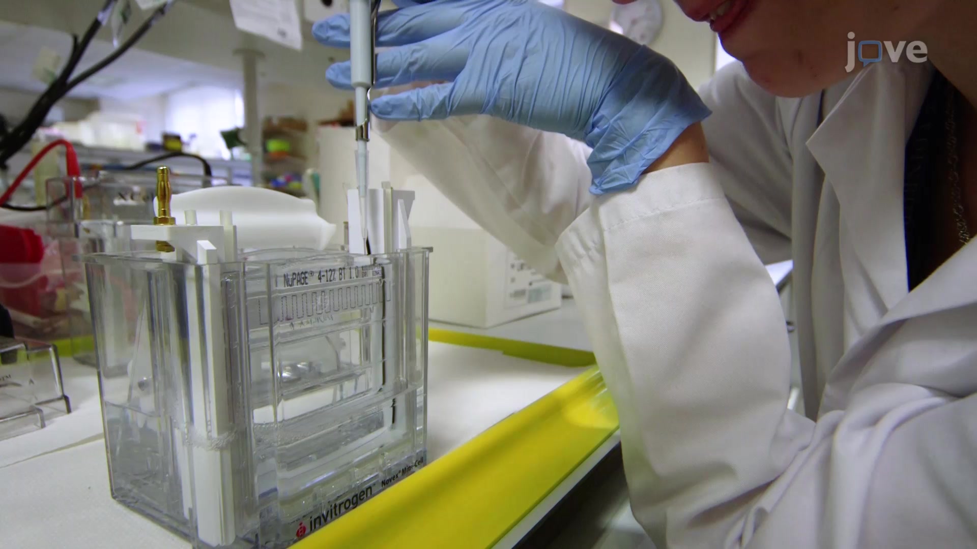 Quantitative Western Blotting to Estimate Protein Expression Levels