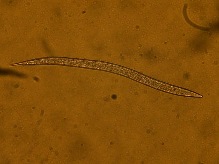 Visualizing Bacteria in Nematodes using Fluorescent Microscopy Protocol