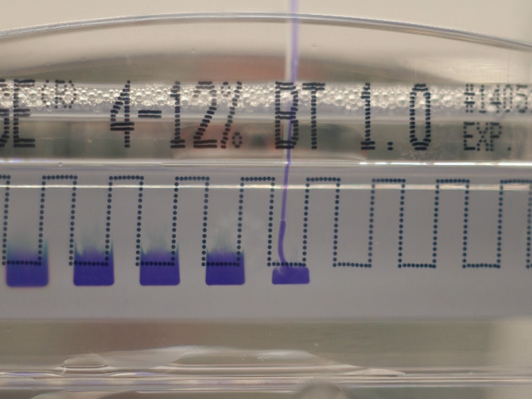 A Guide to Modern Quantitative Fluorescent Western Blotting with