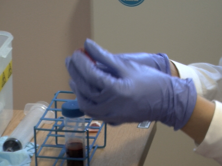 Generation and Culture of Blood Outgrowth Endothelial Cells from Human