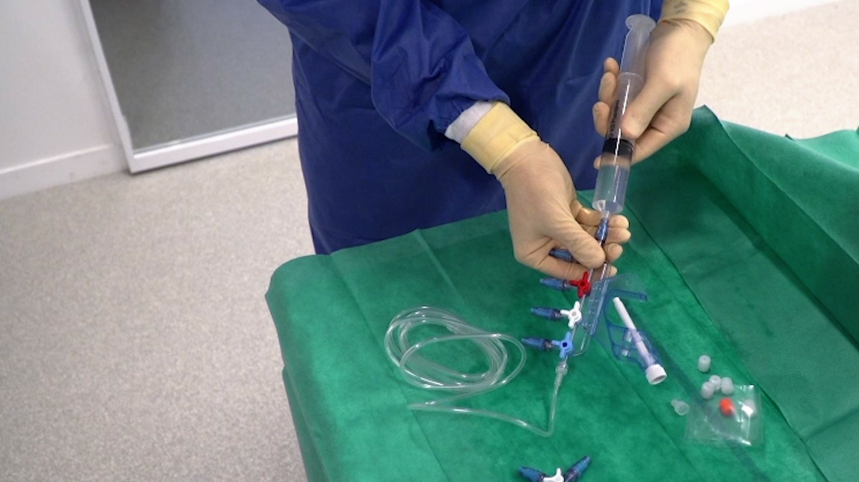 A Protocol to Set Up NeedleFree Connector with Positive Displacement