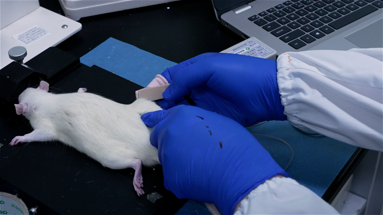 Treating Knee Osteoarthritis with Tuina A New Perspective