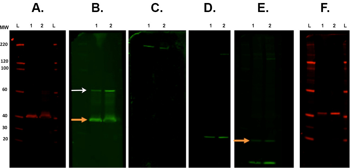 A Guide to Modern Quantitative Fluorescent Western Blotting with