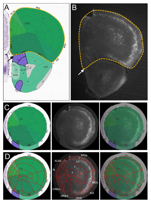 Imagej Measuring Area