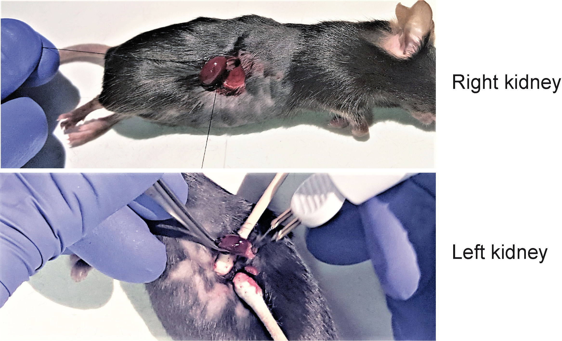Surgical Techniques for Catheter Placement and 5/6 Nephrectomy in