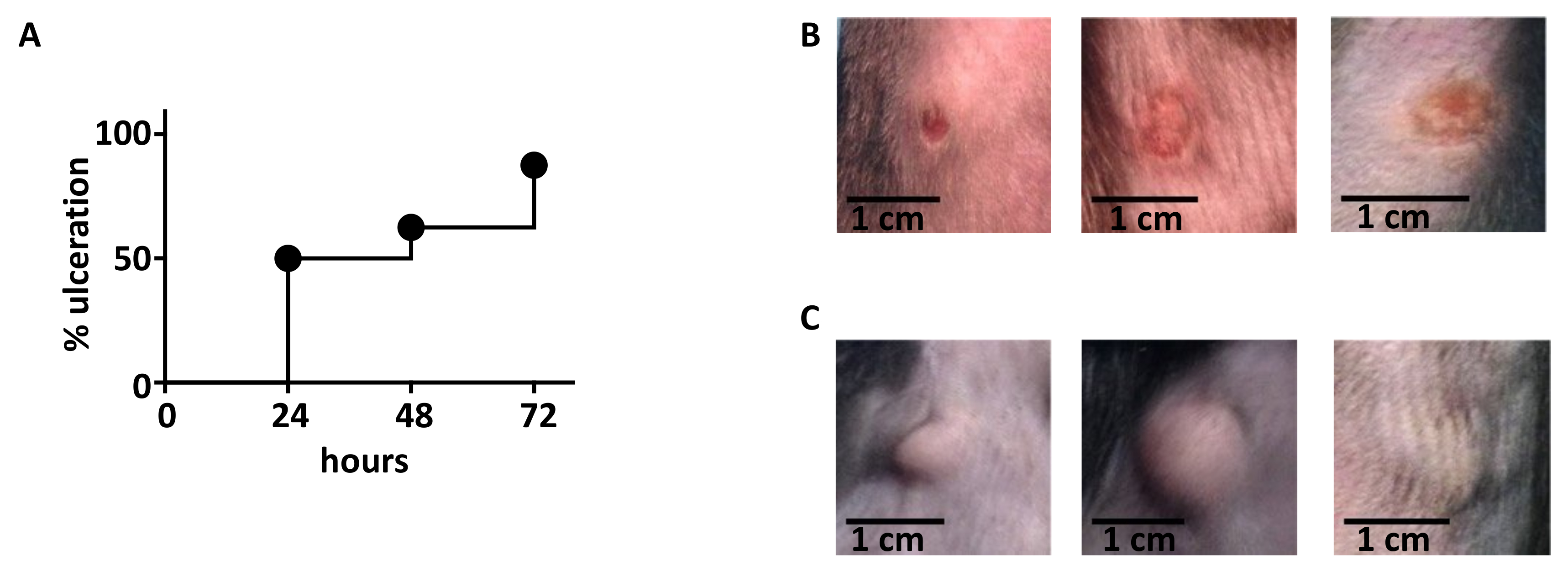 Deep Dermal Injection As a Model of Candida albicans Skin Infection for