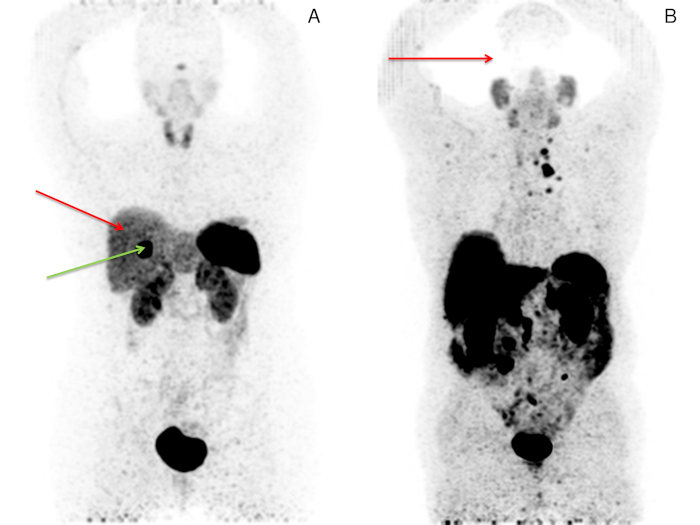 A Practical Guide for the Production and PET/CT Imaging of 68Ga