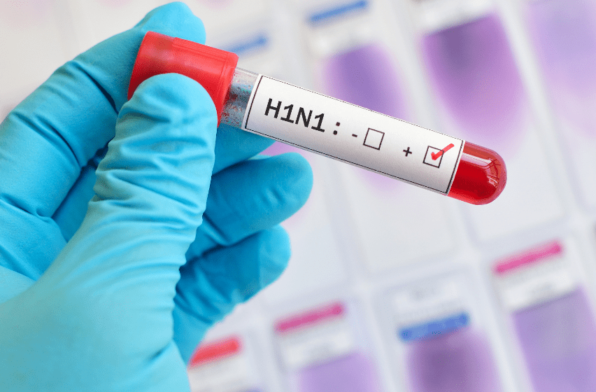 Can Flu Shot Affect Blood Test Results RESUTLOP