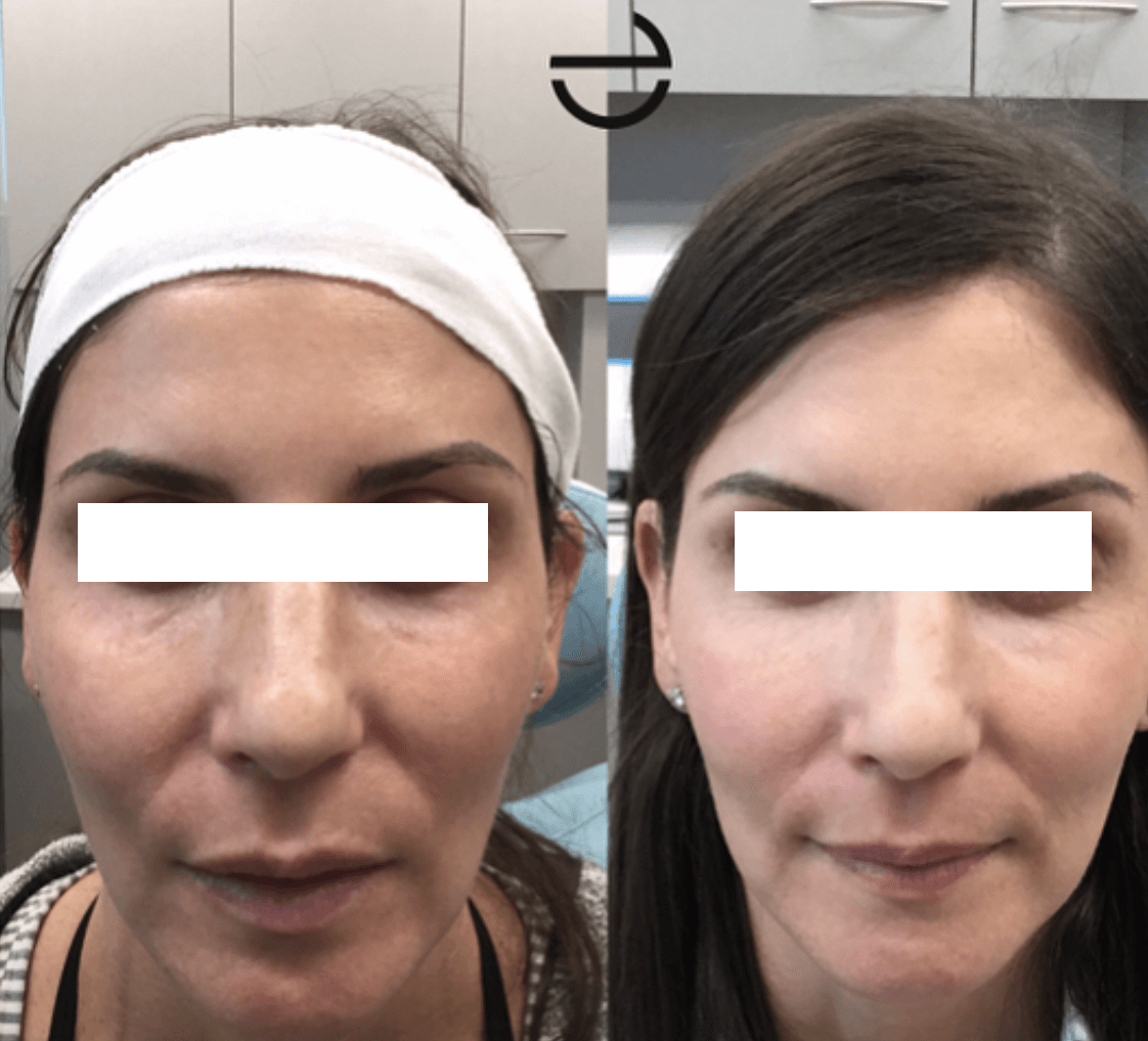 Long Island Laser Dermatology in Jericho, NY Cloudlake