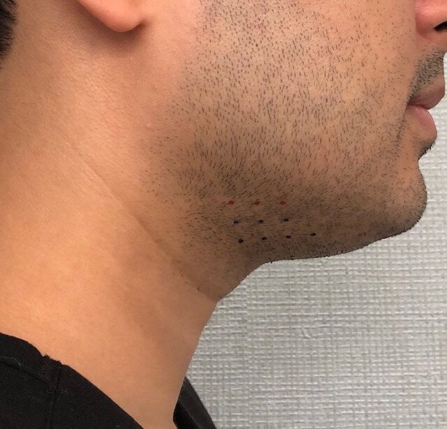 Long Island Cosmetic Dermatologist in Jericho, NY Cloudlake