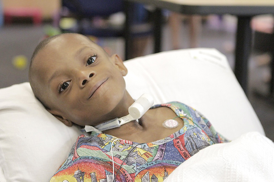 Photo Gallery Cloves Syndrome Community