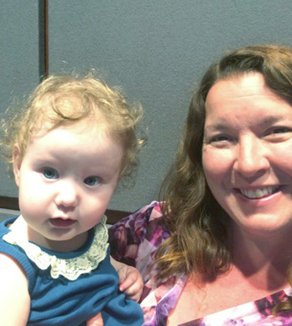 Photo Gallery Cloves Syndrome Community