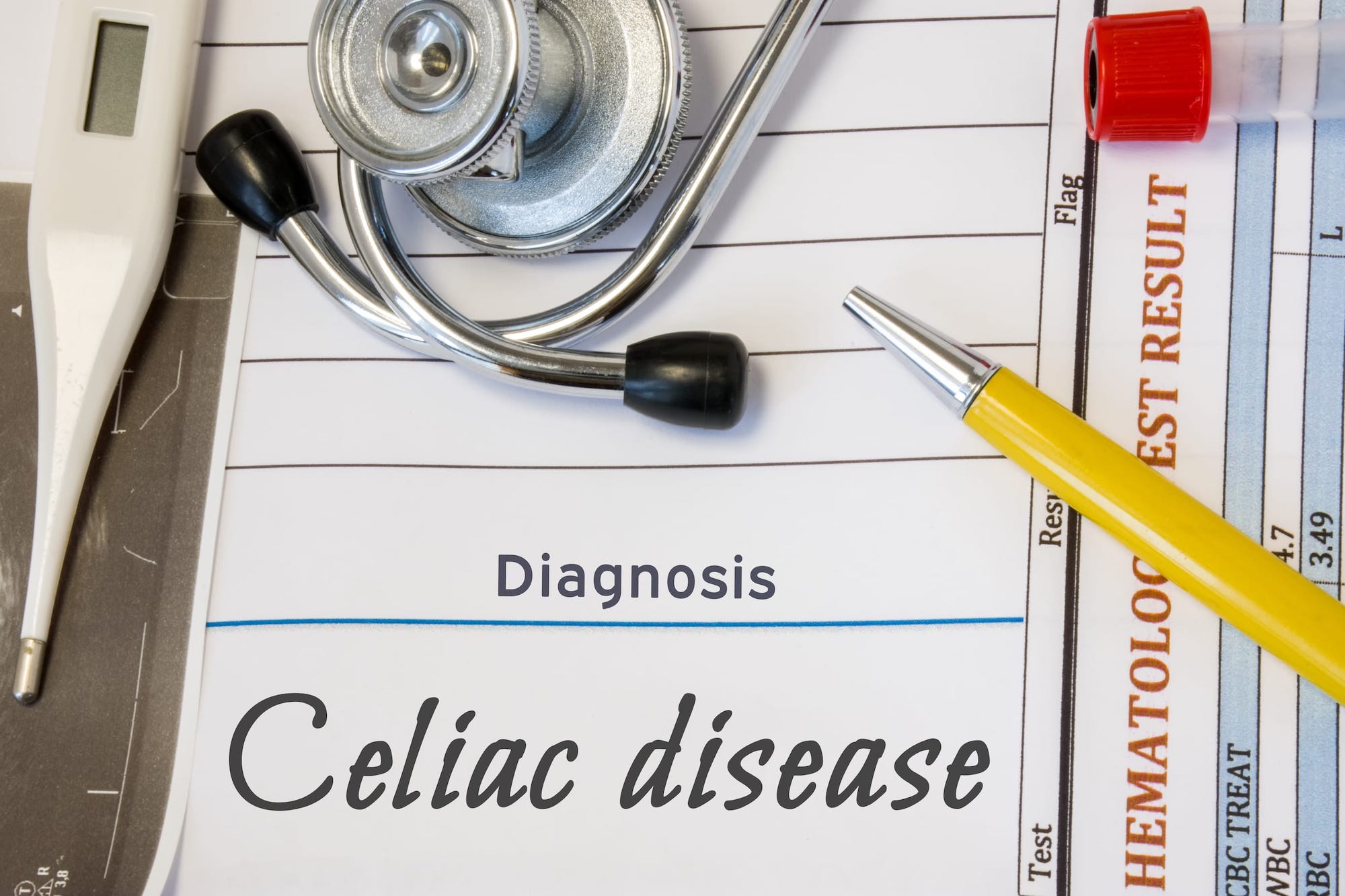 Saliva Test Developed for Diagnosing Celiac Disease Clinical Lab Products
