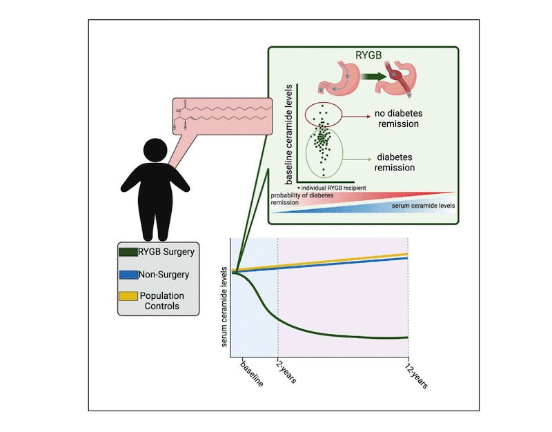 Blood Fat Levels Predict Diabetes Remission Following Gastric Bypass