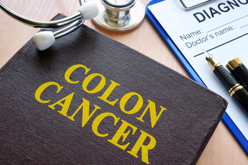 Double Testing More Effective for Identifying Colorectal Cancer