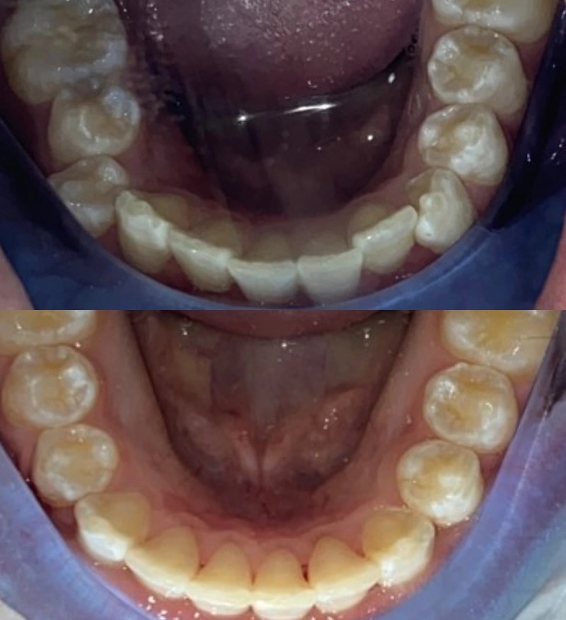 Before & After Clyde North Dental