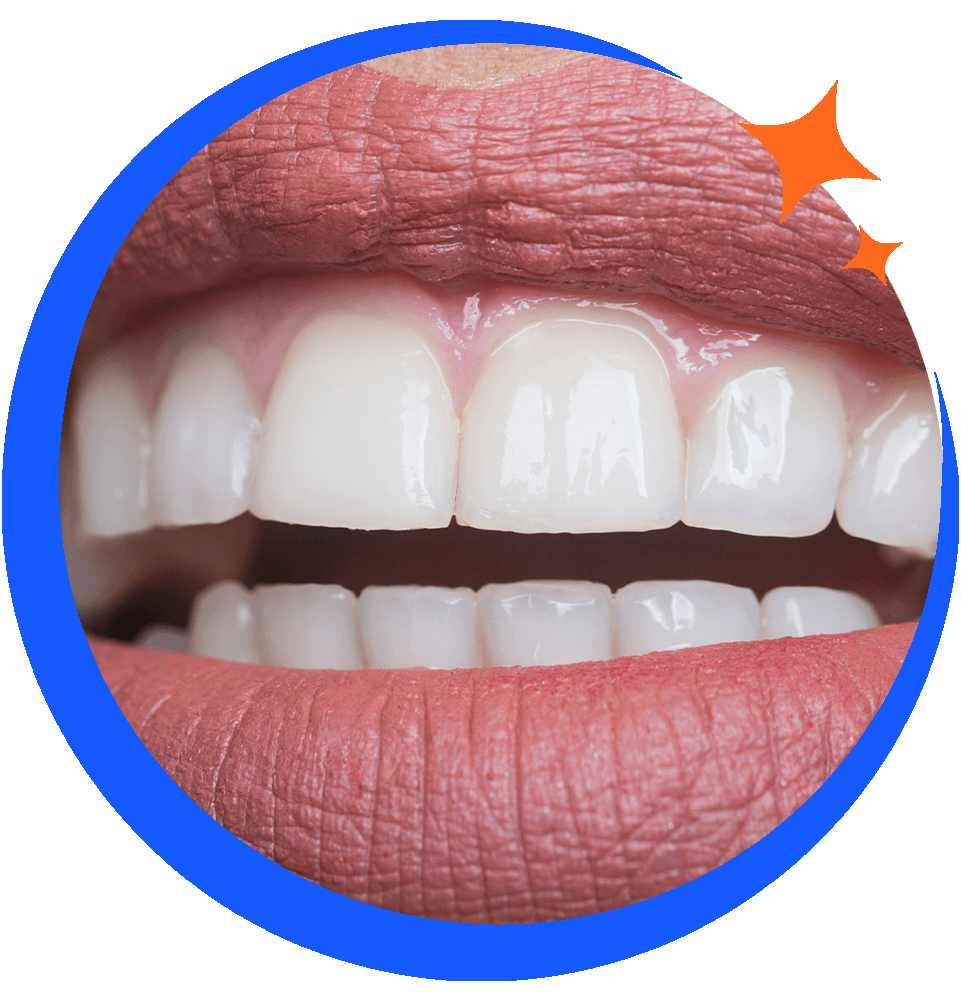 Teeth Whitening Chicago, IL Brighter Smile