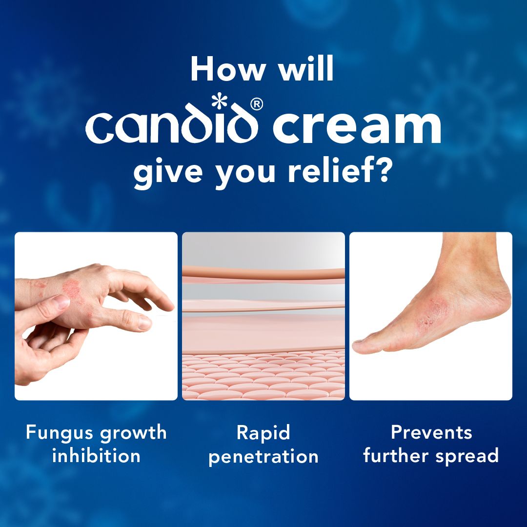 Buy Candid Cream Online Ringworm And Irritation Candid