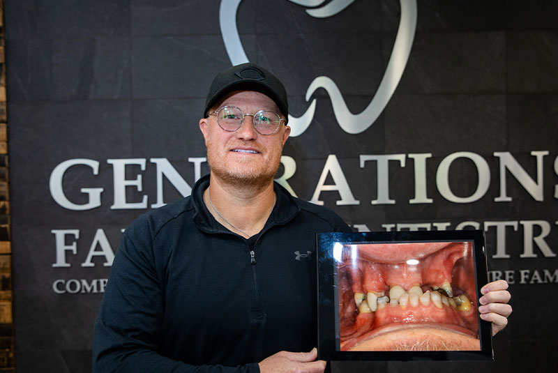 Generations Family Dentistry and Dental Implants Full Mouth Dental
