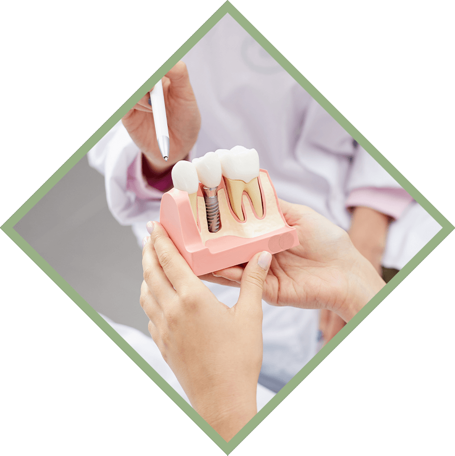 Dental Implants Hagerstown, MD Smile Design Centre