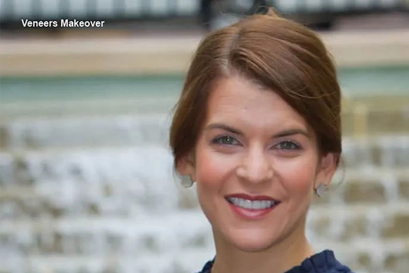 Dental Implants Hagerstown, MD Smile Design Centre