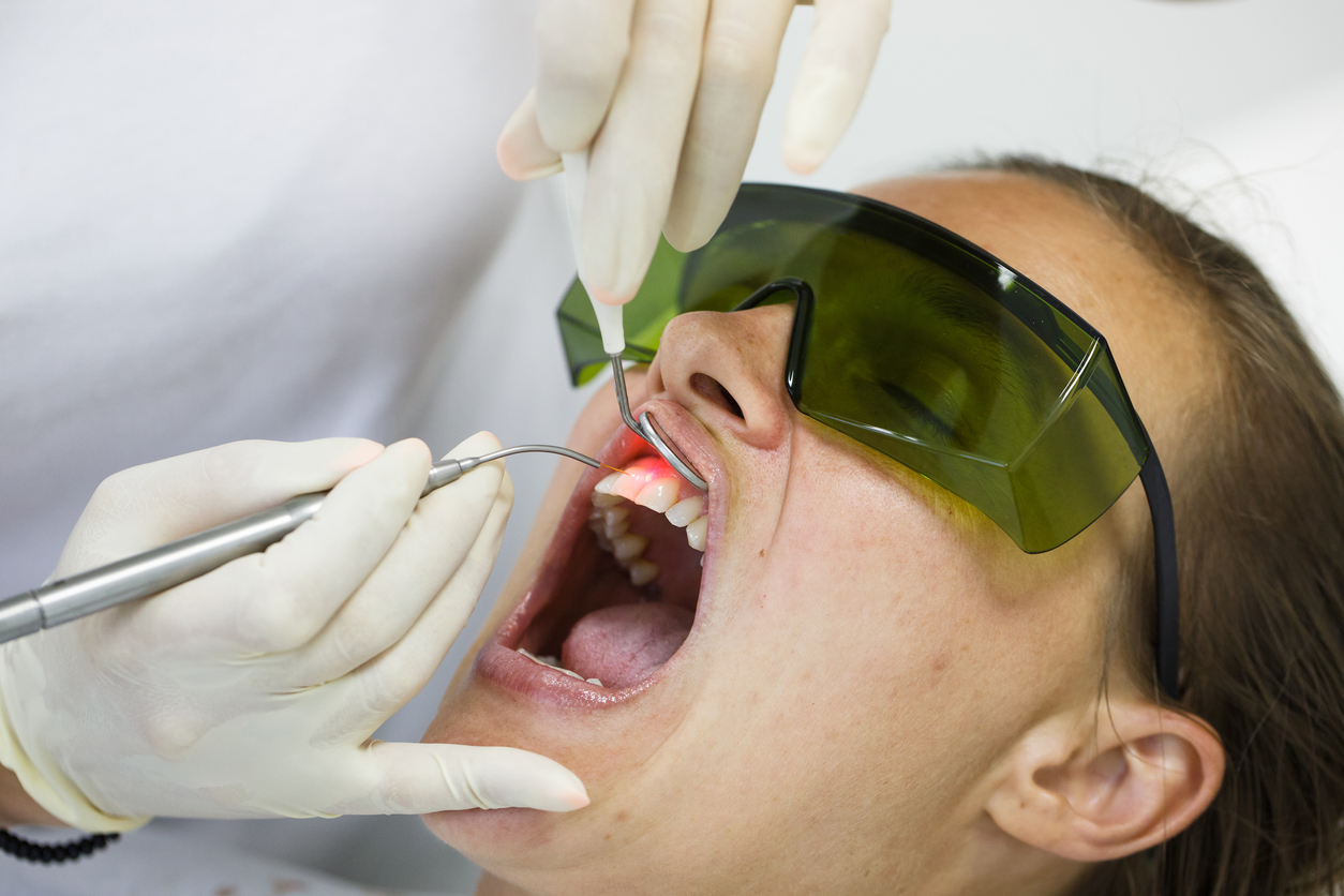 What are the benefits and risks of using lasers to treat tooth