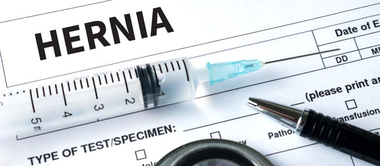 Hernia Mesh Lawsuits and Their Verdicts 6 Pending Cochran Law