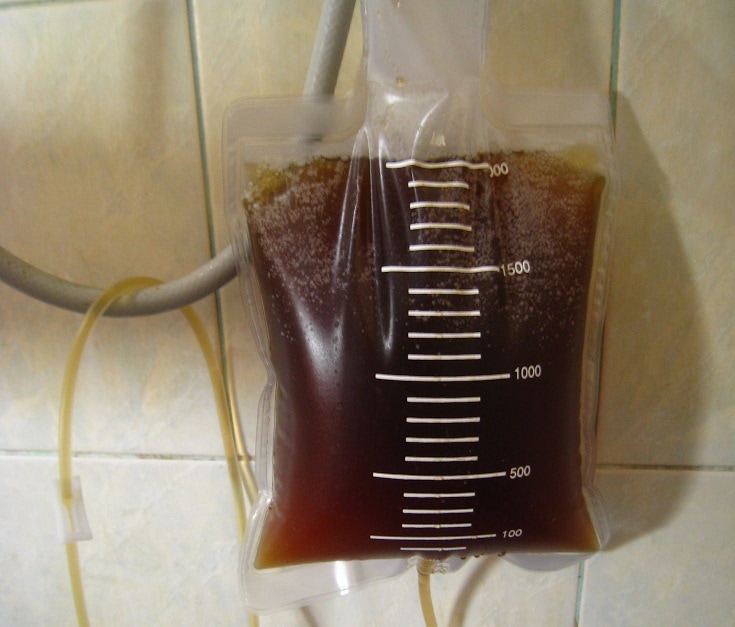 Coffee And Electrolyte Imbalance / Life's a Polyp Hydration via