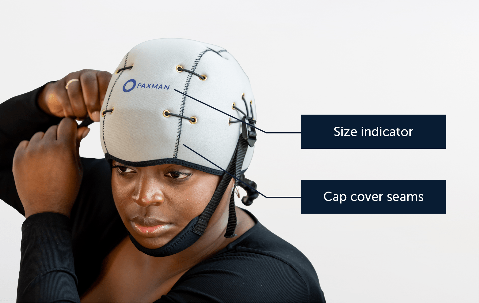 What is scalp cooling?