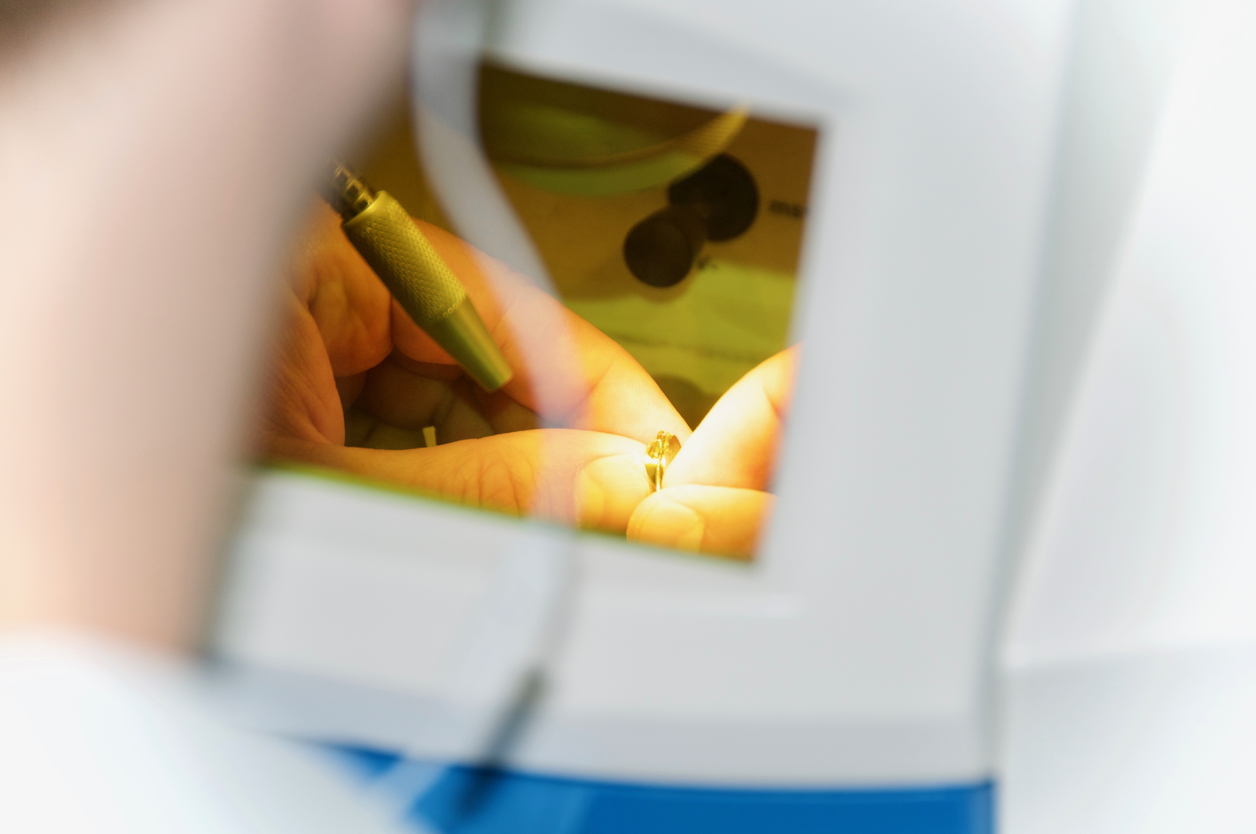 Orthodontic Appliances Cornerstone Orthodontic Laboratory Inc.