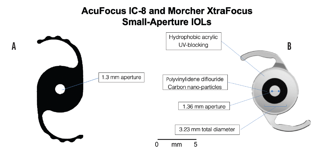 What Is the Optimal Pupil Size? CollaborativeEYE