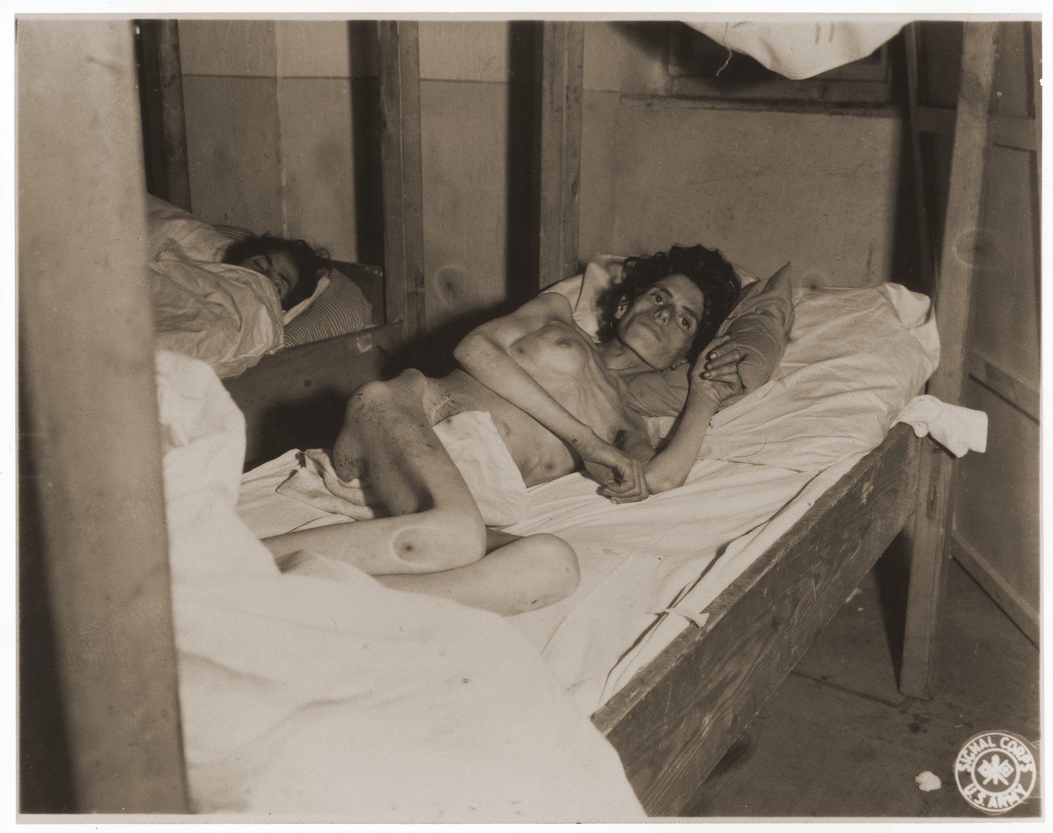 An emaciated female Jewish survivor of a death march lies in an
