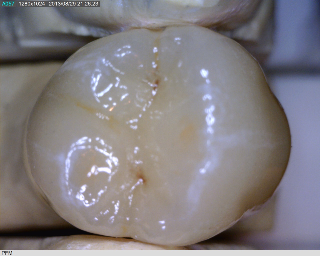 Information/Pictures Colonial Crown Dental Lab