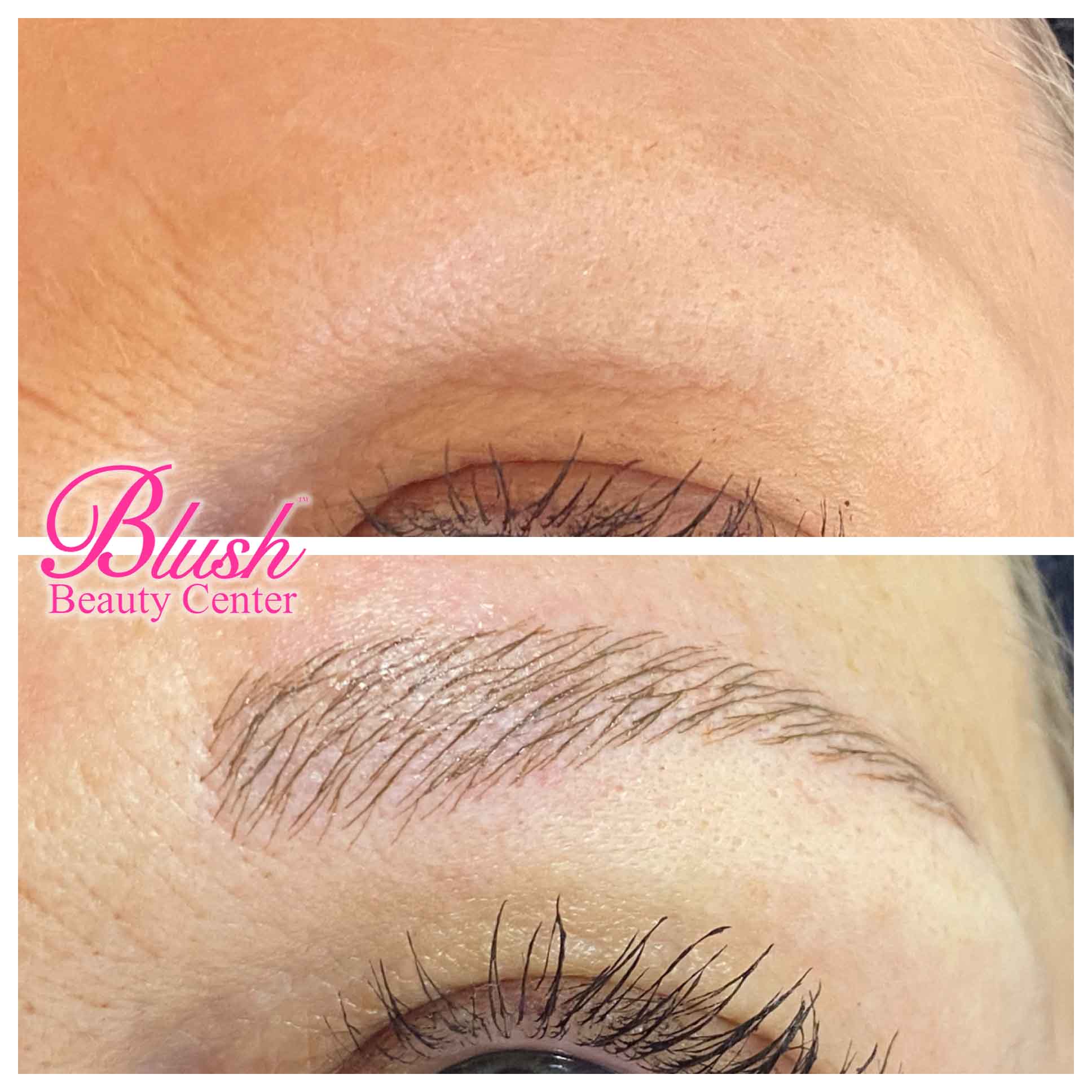 Before and After Results Blush Beauty Center