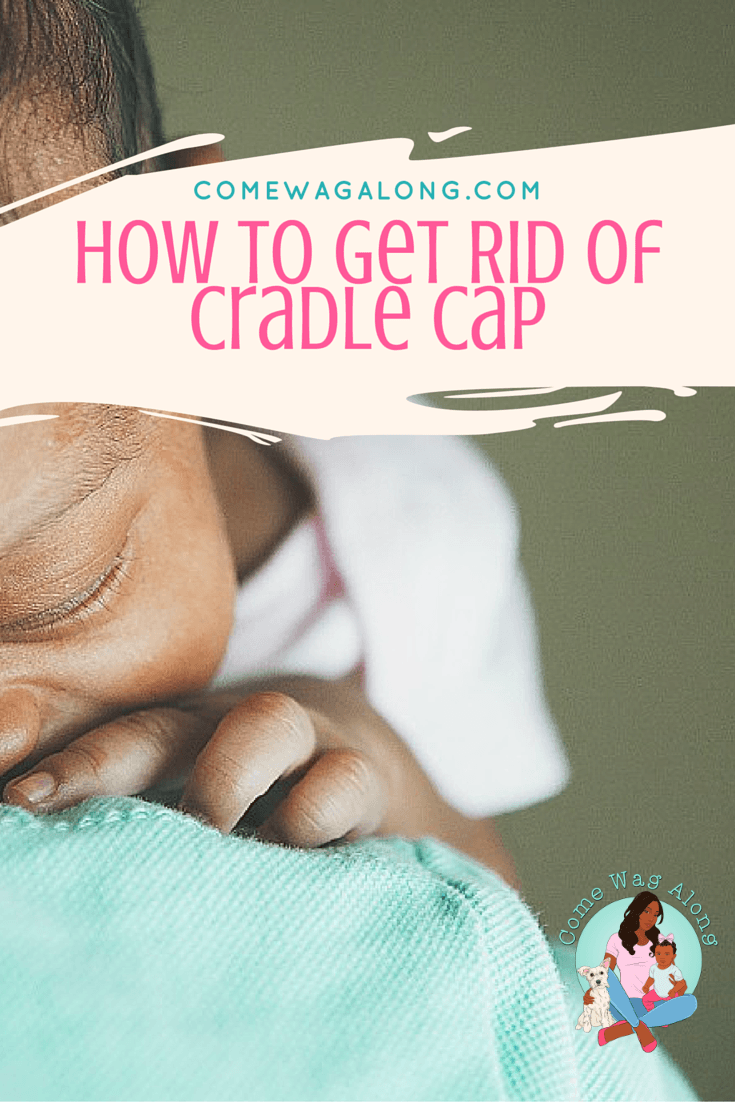 How to Get Rid of Cradle Cap Come Wag Along