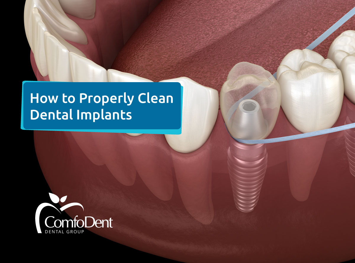 Achieving Optimal Oral Hygiene How to Properly Clean Dental Implants