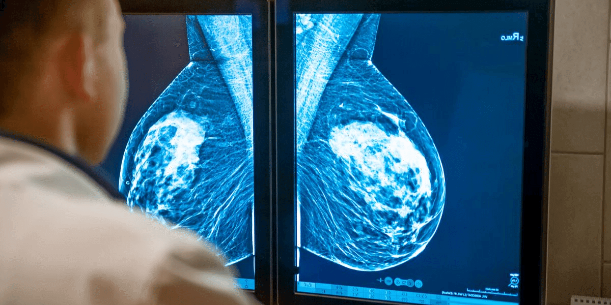 The Difference Between Dense and Nondense Breast Tissue • Health Blog