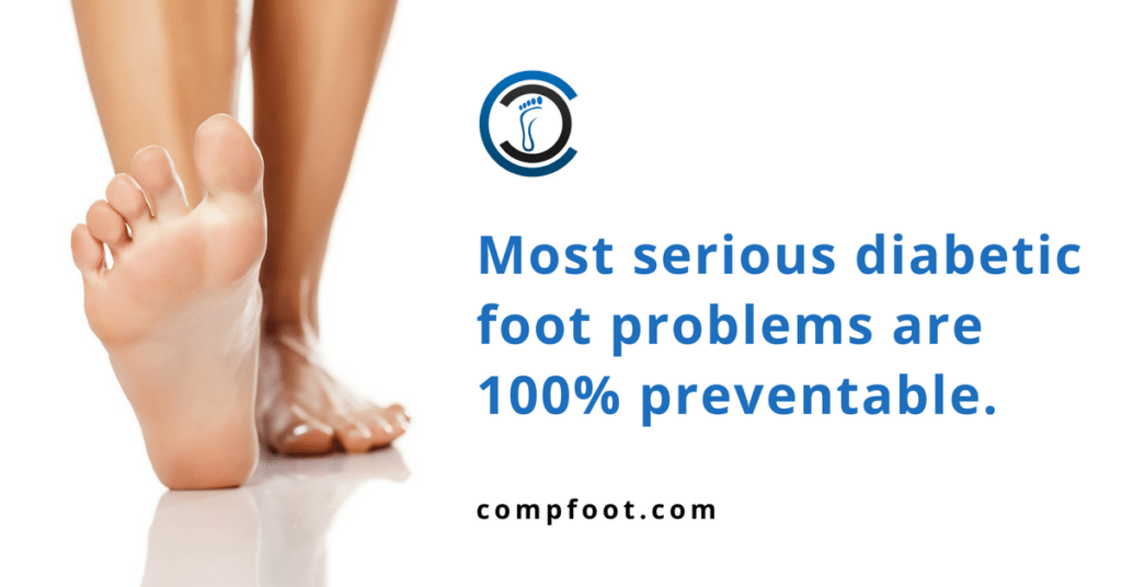 Diabetic Foot Care You Deserve Comprehensive Foot Centers