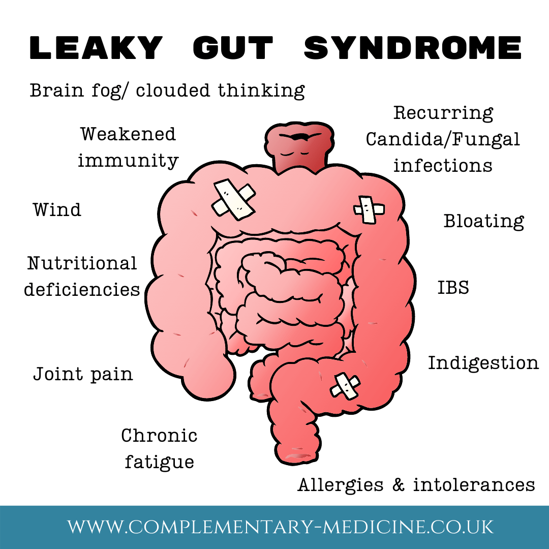 Leaky Gut Syndrome – Complementary Medicine Clinic