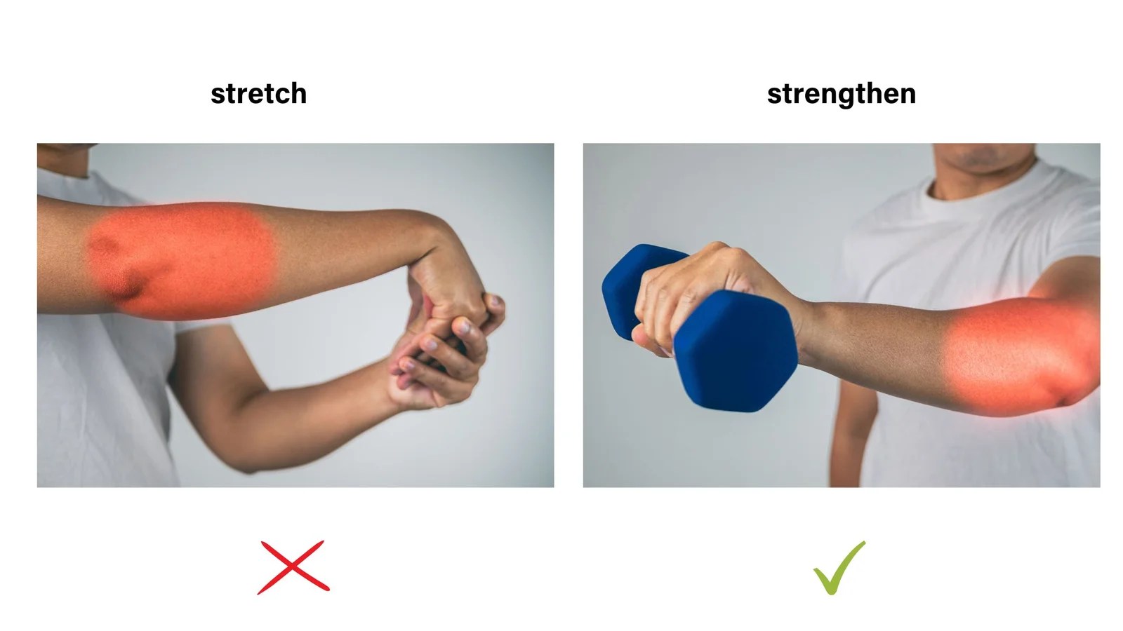 Why is my tennis elbow not getting better? Complete Physio